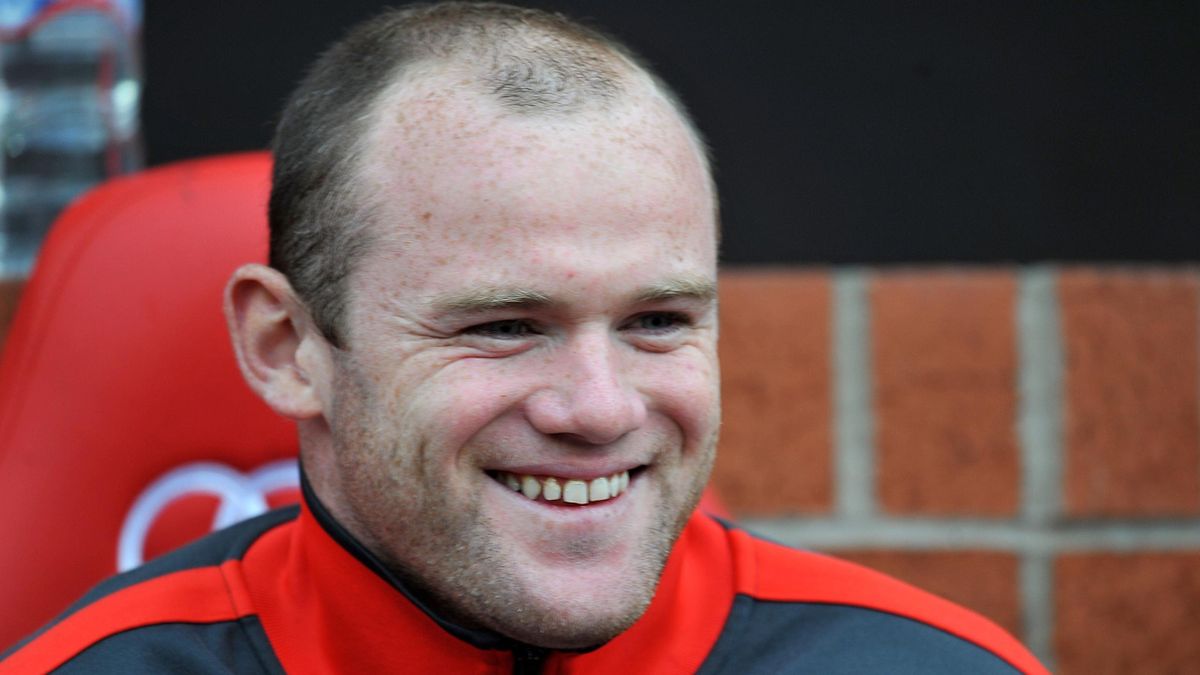 Rooney has hair transplant - Eurosport