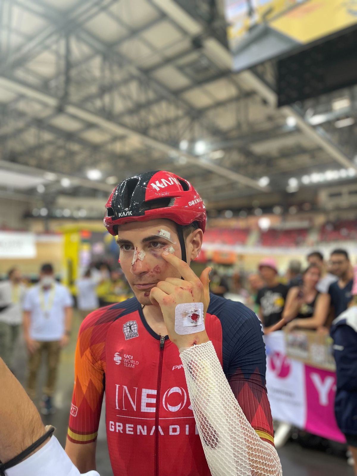 Tour de Francia 2023 | La muy impactante imagen de la cara de Carlos ...