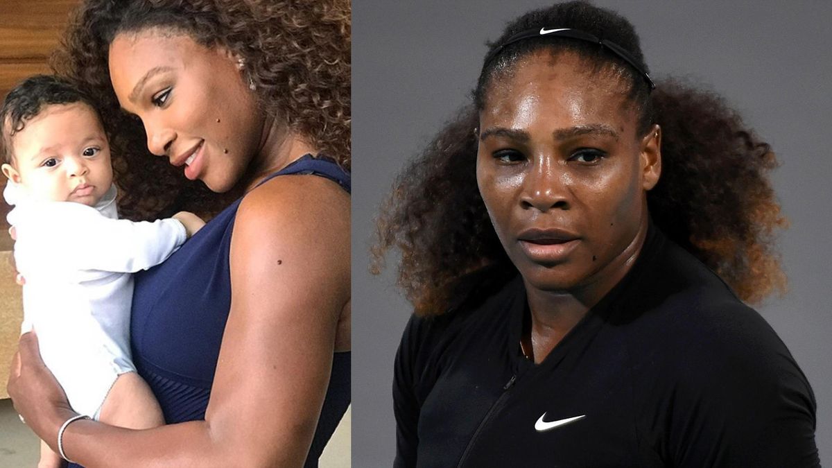 Serena Williams: I almost died after giving birth - Eurosport
