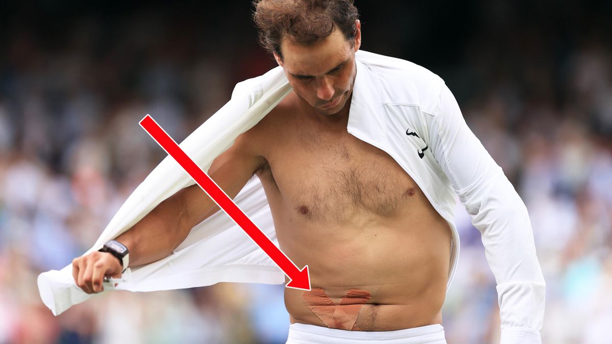 Rafael Nadal suffers abdominal tear during his Wimbledon quarter-final