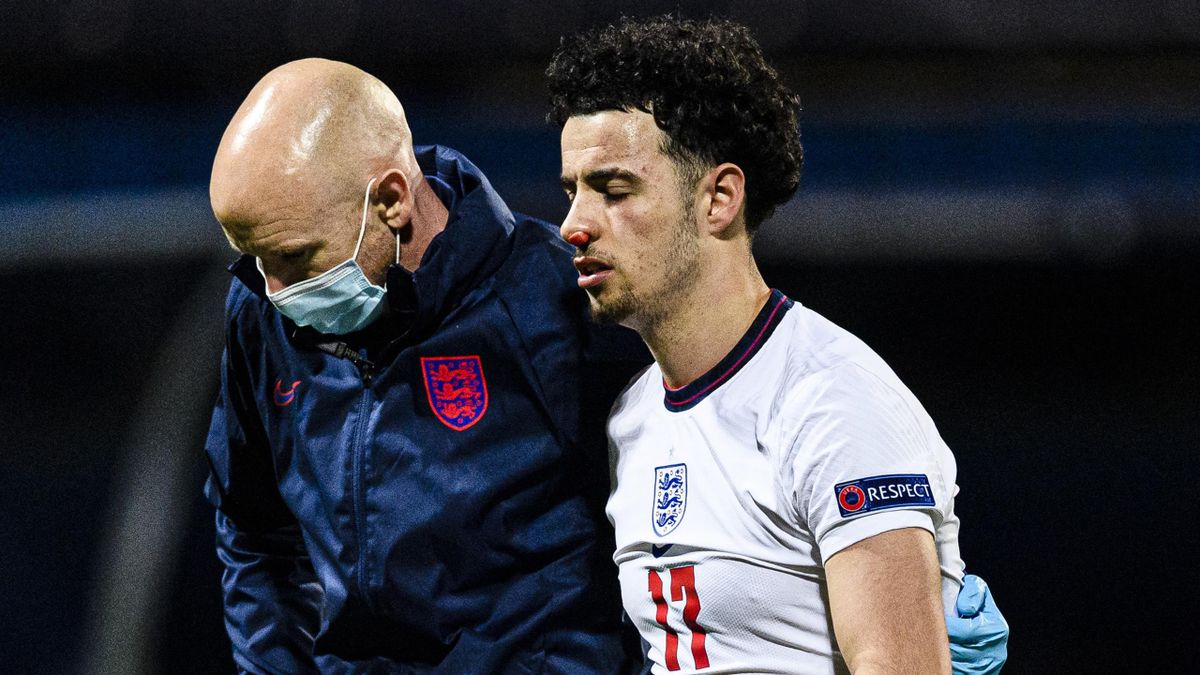 Liverpool S Curtis Jones Sees Red After Clash With Croatia Players Following England U21 Heartbreak Eurosport