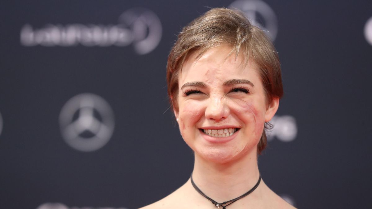 Bebe Vio Diventa Una Barbie E Un Modello Per Le Bambine Eurosport
