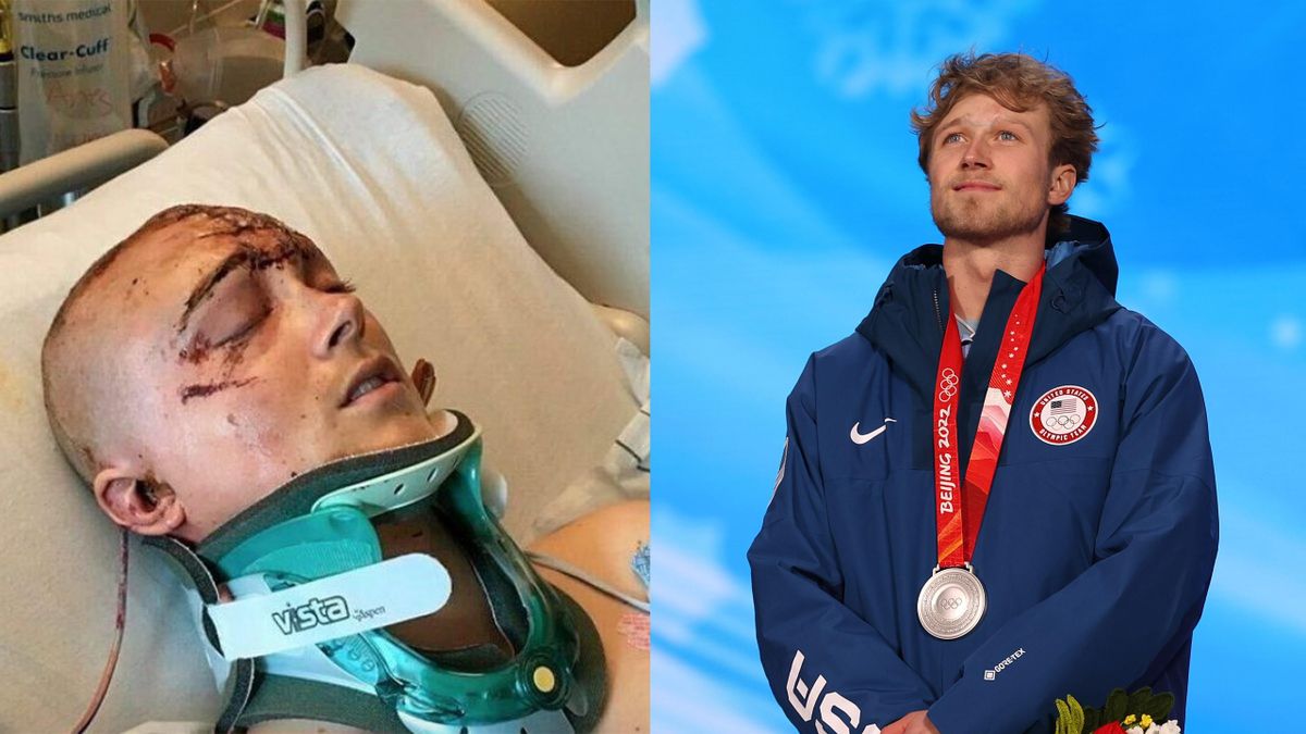 Colby Stevenson conquista l’argento olimpico a 5 anni dall’incidente