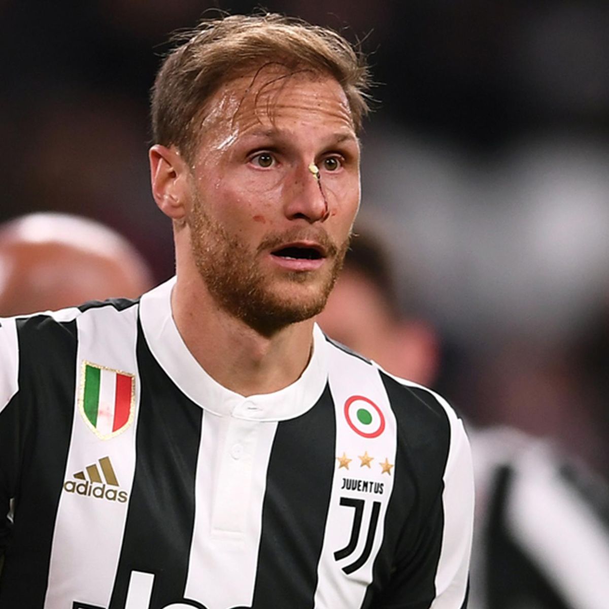 Benedikt Höwedes von Juventus Turin aus dem Champions-League-Kader  gestrichen - Eurosport