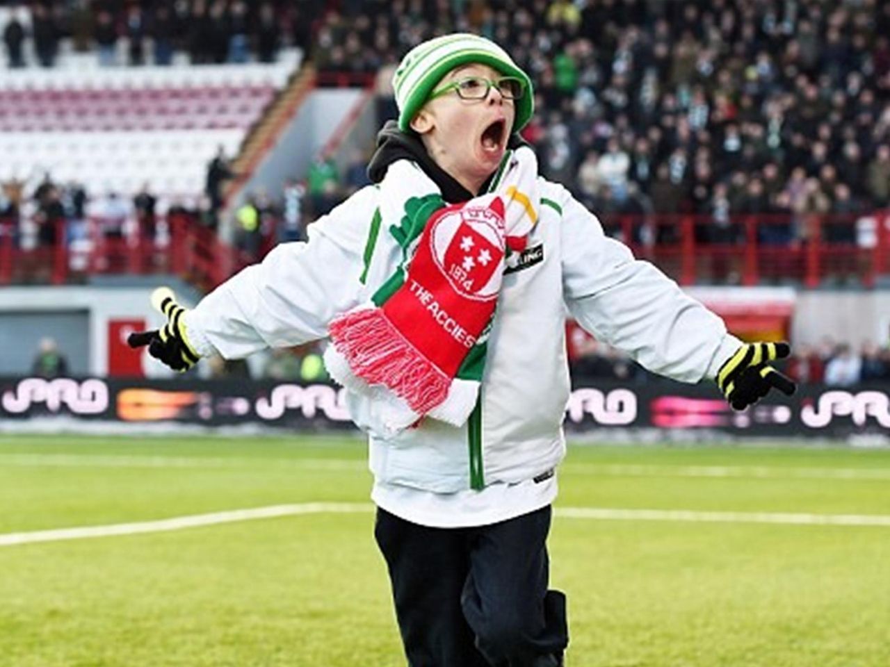 11 letnij fanat seltika s sindromom