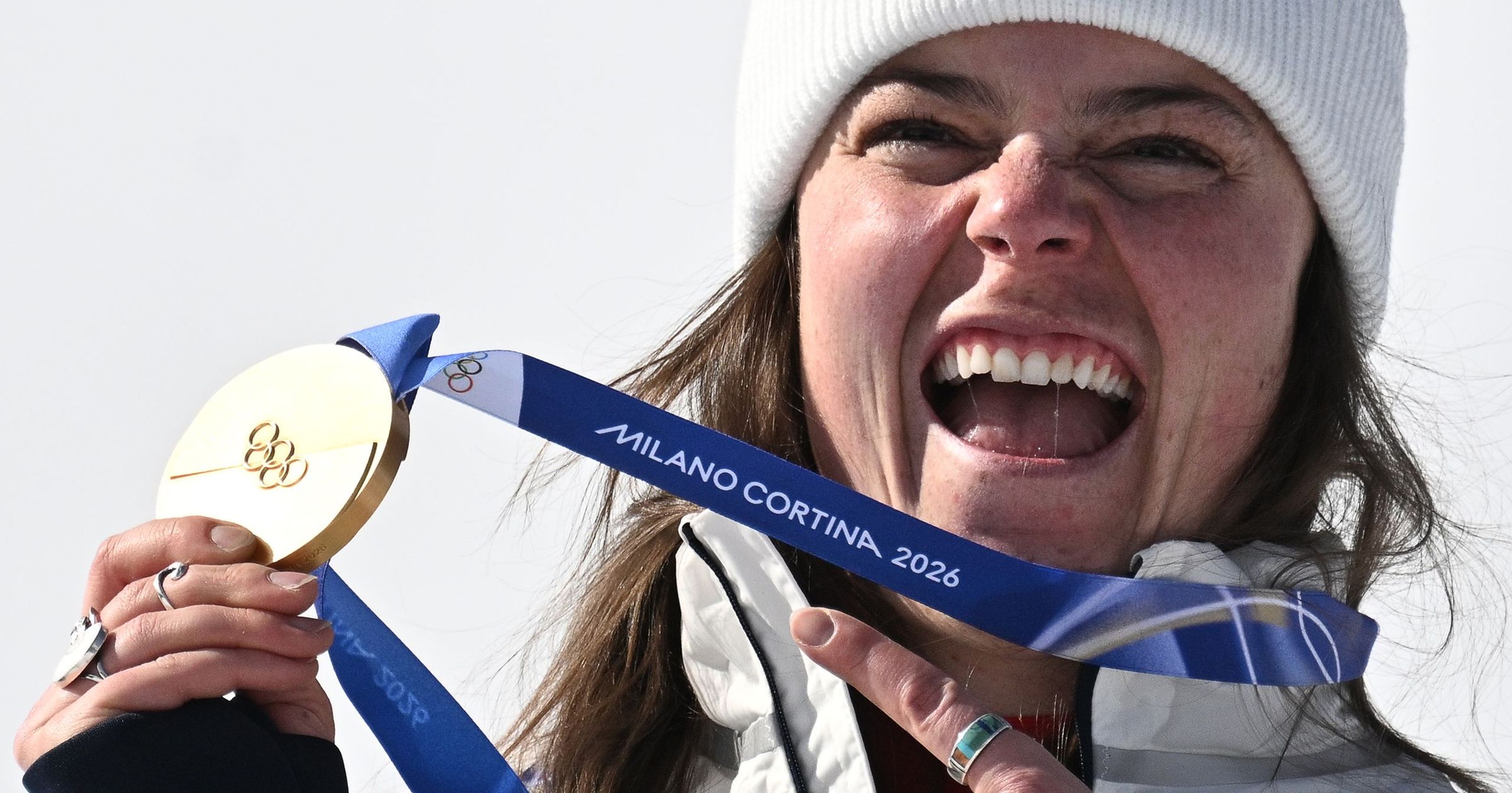 Problémák sorára panaszkodnak a sportolók, már a szervezők is vizsgálódnak az olimpiai érmek miatt Kép