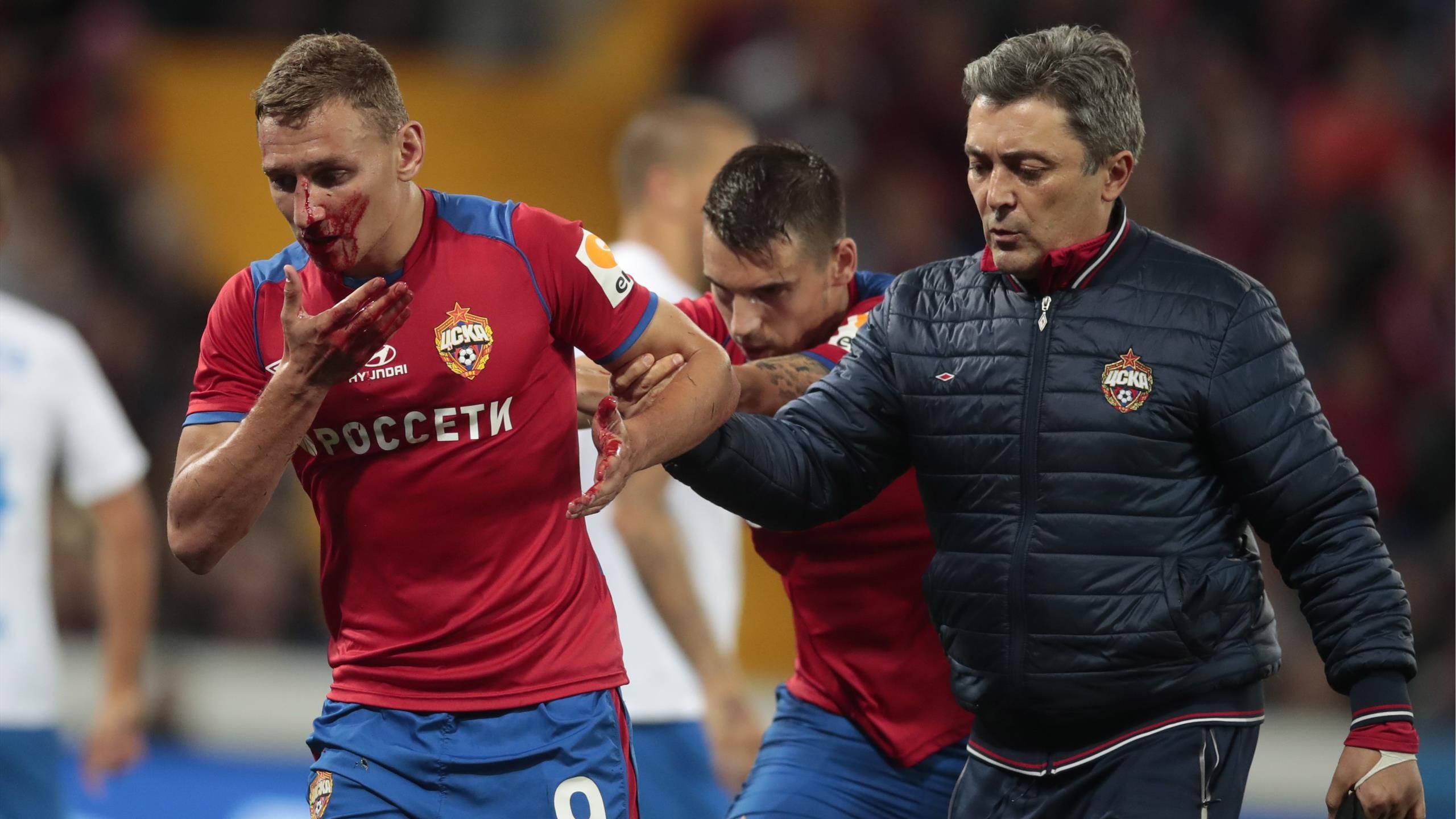 fedoru chalovu slomali nos pered derbi