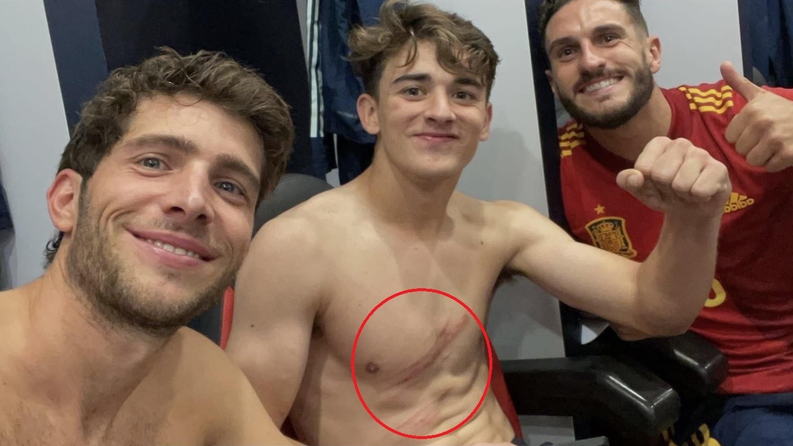 Además, terminó el partido con heridas. 