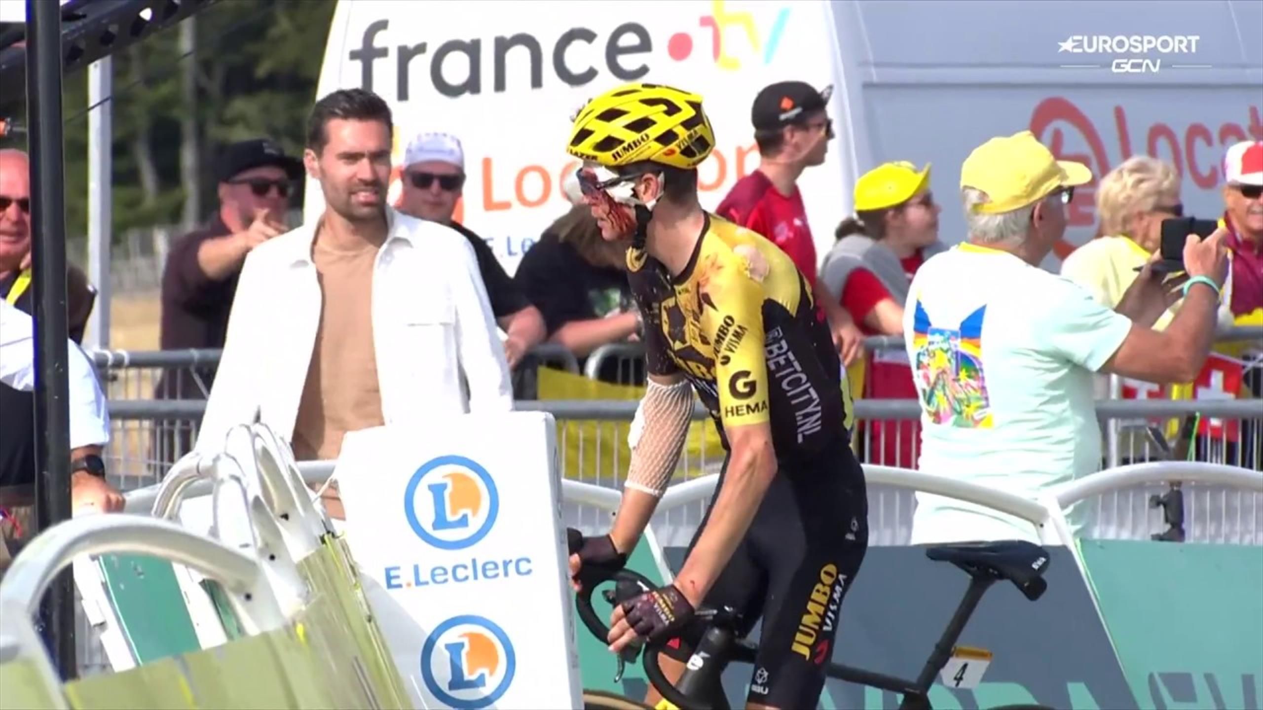 Tour de France Sepp Kuss met bebloed gezicht over de meet