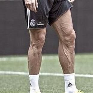 Las piernas de Cristiano Ronaldo valen 103 millones de euros - Eurosport