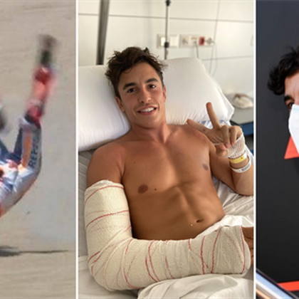 ¿Es humano o es un superhéroe? ¡Marc Márquez podrá correr en Jerez tres días después de ser operado!