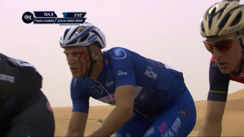 Kittel left with blood pouring from face after alleged punch